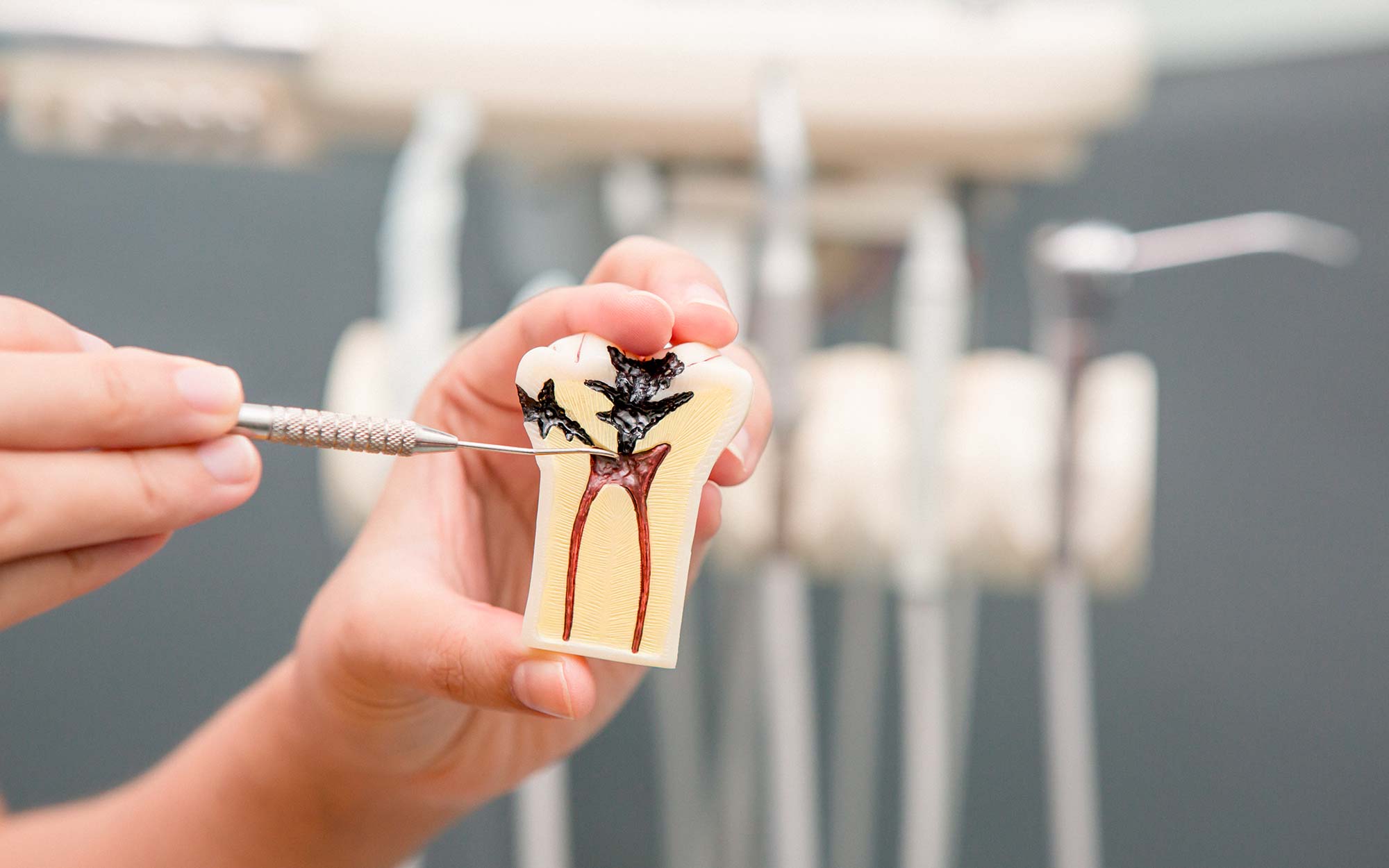 Endodonzia